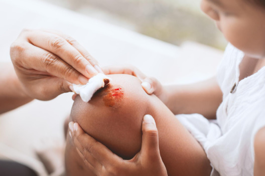 Skin Wound & Ulcer